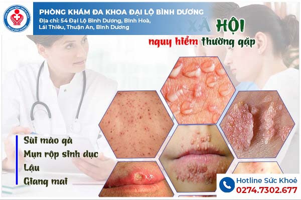 Các loại bệnh xã hội ở nữ giới