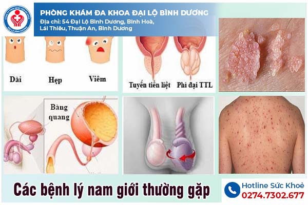 Các bệnh nam giới thường gặp về dương vật