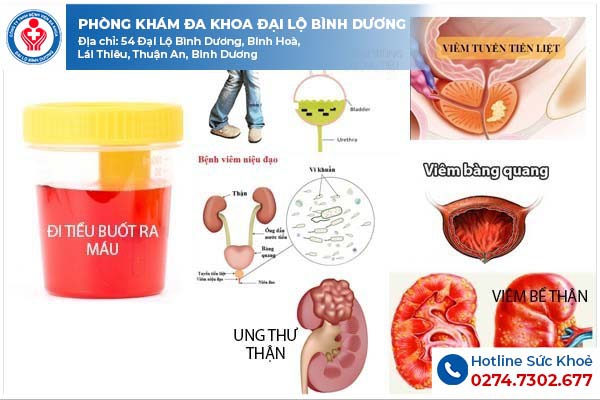 Các bệnh lý gây tình trạng tiểu buốt ra máu