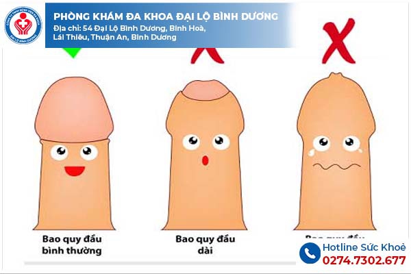 Khi nào nam giới nên cắt bao quy đầu?