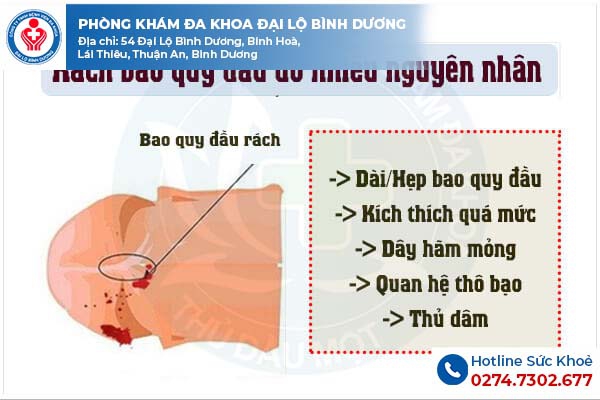Nguyên nhân khiến bao quy đầu bị rách